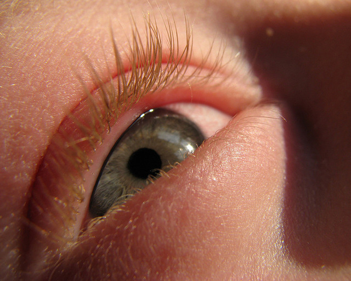 Alergia Molestias oculares