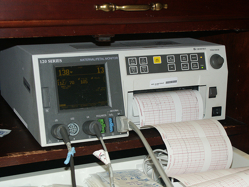 El monitor fetal