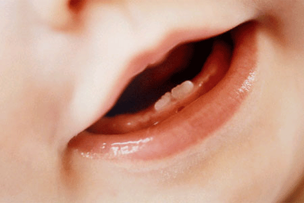 Problemas que pueden surgir con los dientes