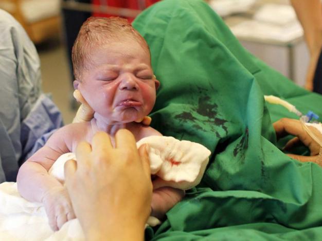 Una mujer polaca da a luz después de 75 días de parto