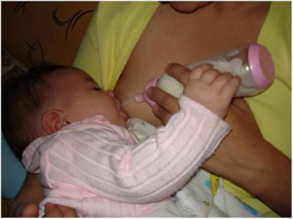 Técnicas alimentarias compatibles con la lactancia materna IV