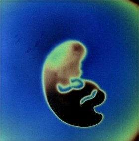 Desarrollo del feto (Primer Mes)