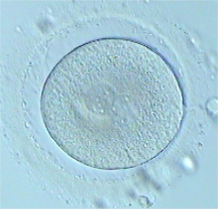 Congelación de embriones