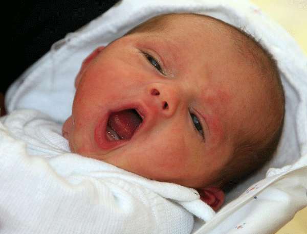 Afecciones bucales en los bebés II