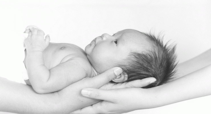 Cabeza deformada por el parto: Cefalohematoma